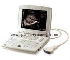 JY-D8 Full digital B type ultrasonic diagnostic instrument ( notebook )